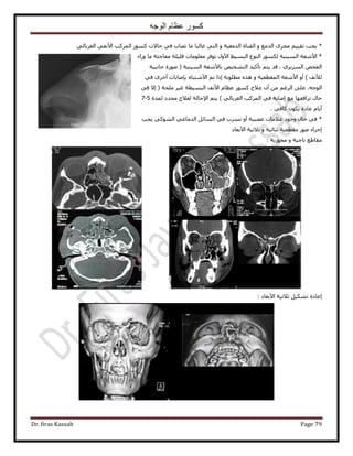 ‫الوجه‬ ‫عظام‬ ‫كسور‬
Dr. firas Kassab Page 79
٢ُ‫حُـَرخ‬ ٢‫ح٧ٗل‬ ‫حًَُٔذ‬ ًٍٞٔ ‫كخ٫ص‬ ٢‫ك‬ ‫طٜخد‬ ‫ٓخ‬ ‫ؿخُزخ‬ ٢‫حُظ‬ ٝ ‫حُيٓؼ٤ش‬ ‫حُو٘خس‬ ٝ ‫حُيٓغ‬ َٟ‫ٓـ‬ ْ٤٤‫طو‬ ‫٣ـذ‬ *
*‫ٍٝحء‬ ‫ٓخ‬ ‫ٓلخؿجش‬ ‫هِ٤ِش‬ ‫ٓؼِٞٓخص‬ َ‫طٞك‬ ٍٝ٧‫ح‬ ٢٤ٔ‫حُز‬ ‫حُ٘ٞع‬ ٌٍُٞٔ ‫حُٔ٤٘٤ش‬ ‫ح٧ٗؼش‬
١َ٣َُٔ‫ح‬ ٚ‫حُلل‬‫حُٔ٤٘٤ش‬ ‫رخ٧ٗؼش‬ ٚ٤‫حُظ٘و‬ ‫طؤً٤ي‬ ْ‫٣ظ‬ ‫هي‬ .‫ؿخٗز٤ش‬ ‫ٍٛٞس‬ (
) ‫ُ٨ٗق‬ٝ ‫حُٔوطؼ٤ش‬ ‫ح٧ٗؼش‬ ٝ‫أ‬٢‫ك‬ َٟ‫أه‬ ‫ربٛخرخص‬ ٙ‫ح٧ٗظزخ‬ ْ‫ط‬ ‫اًح‬ ‫ٓطِٞرش‬ ٌٙٛ
‫ِٓلش‬ َ٤‫ؿ‬ ‫حُزٔ٤طش‬ ‫ح٧ٗق‬ ّ‫ػظخ‬ ًٍٞٔ ‫ػ٬ؽ‬ ٕ‫أ‬ ٖٓ ْ‫حَُؿ‬ ٠ِ‫ػ‬ .ٚ‫حُٞؿ‬٢‫ك‬ ٫‫ا‬ (
) ٢ُ‫حُـَرخ‬ ‫حًَُٔذ‬ ٢‫ك‬ ‫اٛخرش‬ ‫ٓغ‬ ‫طَحكوٜخ‬ ٍ‫كخ‬ٓ ‫ُؼ٬ؽ‬ ‫ح٩كخُش‬ ْ‫٣ظ‬‫ُٔيس‬ ‫ليى‬5-7
٢‫ًخك‬ ٌٕٞ٣ ‫ػخىس‬ ّ‫أ٣خ‬.
‫٣ـذ‬ ٢ًُٞ٘‫ح‬ ٢‫حُيٓخؿ‬ َ‫حُٔخث‬ ٢‫ك‬ ‫طَٔد‬ ٝ‫أ‬ ‫ػٜز٤ش‬ ‫ػ٬ٓخص‬ ‫ٝؿٞى‬ ٍ‫كخ‬ ٢‫ك‬ *
‫ح٧رؼخى‬ ‫ػ٬ػ٤ش‬ ٝ ‫ػ٘خث٤ش‬ ‫ٓوطؼ٤ش‬ ٍٞٛ ‫اؿَحء‬
: ‫ٓلٍٞ٣ش‬ ٝ ‫طخؿ٤ش‬ ‫ٓوخ١غ‬
: ‫ح٧رؼخى‬ ‫ػ٬ػ٤ش‬ َ٤ٌ٘‫ط‬ ‫اػخىس‬
 