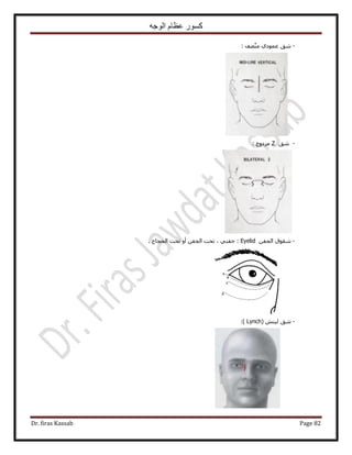 ‫الوجه‬ ‫عظام‬ ‫كسور‬
Dr. firas Kassab Page 82
-‫ٗن‬‫ػٔٞى‬: ‫ٜق‬٘ٓ ١
-‫ٗن‬Z: ‫ِٓىٝؽ‬
-‫ٗوٞم‬ٖ‫حُـل‬Eyelid. ‫حُلـخؽ‬ ‫طلض‬ ٝ‫أ‬ ٖ‫حُـل‬ ‫طلض‬ ، ٢٘‫ؿل‬ :
-‫ٗن‬ٖ٘٤ُ(Lynch):
 
