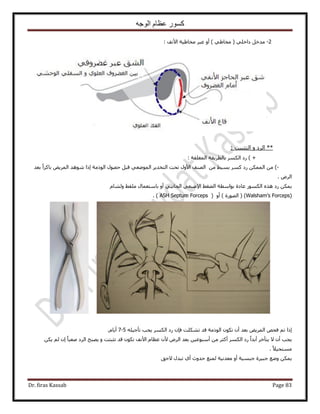 ‫الوجه‬ ‫عظام‬ ‫كسور‬
Dr. firas Kassab Page 83
2-ٝ‫أ‬ ) ٢١‫ٓوخ‬ ( ٢ِ‫ىحه‬ َ‫ٓيه‬‫ح٧ٗق‬ ‫ٓوخ١٤ش‬ َ‫ػز‬:
: ‫حُظؼز٤ض‬ ٝ ‫حَُى‬ **
) +‫حُٔـِوش‬ ‫رخُطَ٣وش‬ ٌَُٔ‫ح‬ ‫ٍى‬:
-)ٖٓ ٢٤ٔ‫ر‬ ًَٔ ‫ٍى‬ ٌُٖٔٔ‫ح‬ ٖٓ‫رؼي‬ ً‫ح‬ًَ‫رخ‬ ٞ٣َُٔ‫ح‬ ‫ٗٞٛي‬ ‫اًح‬ ‫حًُٞٓش‬ ٍٜٞ‫ك‬ َ‫هز‬ ٢‫حُٟٔٞؼ‬ َ٣‫حُظوي‬ ‫طلض‬ ٍٝ٧‫ح‬ ‫حُٜ٘ق‬
َُٝ‫ح‬.
ٌٙٛ ‫ٍى‬ ٌٖٔ٣ّ‫ُٝ٘خ‬ ٢‫ِٓو‬ ٍ‫رخٓظؼٔخ‬ ٝ‫أ‬ ٢‫حُـخٗز‬ ٢‫ح٩ٛزؼ‬ ٢‫حُ٠ـ‬ ‫رٞحٓطش‬ ‫ػخىس‬ ٌٍُٞٔ‫ح‬
(Walsham’s Forceps)) ‫حٍُٜٞس‬ (( ٝ‫أ‬ASH Septum Forceps).
ِٚ٤‫طؤؿ‬ ‫٣ـذ‬ ٌَُٔ‫ح‬ ‫ٍى‬ ٕ‫كب‬ ‫طٌِ٘ض‬ ‫هي‬ ‫حًُٞٓش‬ ٌٕٞ‫ط‬ ٕ‫أ‬ ‫رؼي‬ ٞ٣َُٔ‫ح‬ ٚ‫كل‬ ْ‫ط‬ ‫اًح‬5-7.ّ‫أ٣خ‬
ٖٓ َ‫أًؼ‬ ٌَُٔ‫ح‬ ‫ٍى‬ ً‫ح‬‫أري‬ َ‫٣ظؤه‬ ٫ ٕ‫أ‬ ‫٣ـذ‬ٝ ‫طؼزظض‬ ‫هي‬ ٌٕٞ‫ط‬ ‫ح٧ٗق‬ ّ‫ػظخ‬ ٕ٧ َُٝ‫ح‬ ‫رؼي‬ ٖ٤‫أٓزٞػ‬ٌٖ٣ ُْ ٕ‫ا‬ ً‫خ‬‫ٛؼز‬ ‫حَُى‬ ‫٣ٜزق‬
ً٬٤‫ٓٔظل‬.
‫٫كن‬ ٍ‫طزي‬ ١‫أ‬ ‫كيٝع‬ ‫ُٔ٘غ‬ ‫ٓؼيٗ٤ش‬ ٝ‫أ‬ ‫ؿزٔ٤ش‬ ‫ؿز٤َس‬ ‫ٟٝغ‬ ٌٖٔ٣
 