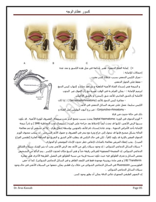 ‫الوجه‬ ‫عظام‬ ‫كسور‬
Dr. firas Kassab Page 85
)+‫حُيٓؼ٤ش‬ ‫حُو٘خس‬ ‫اٛخرش‬َ‫طؼظز‬ :‫ػيس‬ ‫ٗـي‬ ٝ ٌٍُٞٔ‫ح‬ ٌٙٛ َ‫ٓؼ‬ ٢‫ك‬ ‫ٗخثؼش‬
: ‫ُ٪ٛخرش‬ ‫اكظٔخ٫ص‬
-‫ٓلظض‬ ًَٔ ‫ٗظخ٣خ‬ ‫رٔزذ‬ ٢‫حُيٓؼ‬ ْ٤ٌُ‫ح‬ ‫طِٔم‬
-٢‫حُيٓؼ‬ ُ‫حُـٜخ‬ ٠ِ‫ػ‬ ٢‫ٟـ‬
ُ‫ح‬ ‫اٗٔيحى‬ ٢ٛ ‫حُ٘ظ٤ـش‬ ٝ‫و٘خس‬٧‫ح‬٤‫ٗل‬‫ش‬ُ‫ح‬٤‫يٓؼ‬‫ٗ٘خٛي‬ ٝ ‫ش‬‫ىٓخع‬ٝ‫ا‬‫حُيٓغ‬ ْ٤ً ‫ُظٜخد‬
: ‫ح٩ٛخرش‬ ْ٤َٓ‫ُظ‬-ّ‫حُو٤خ‬ ٌٖٔ٣‫حُ٘يٝد‬ َ‫ػز‬ ‫حُٔٞم‬ ‫ٍأد‬ ‫ٓغ‬ ٚٔ‫ٗل‬ ‫حُٞهض‬ ٢‫ك‬ ٚ‫ر‬
٢ِ٤ًِ٩‫ح‬ ‫رخُ٘ن‬ ٝ‫أ‬ )ٖ٘٤ُ( ‫ٗن‬ ‫ُ٨ٗق‬ ٢‫حُـخٗز‬ ‫رخُ٘ن‬ ٝ‫أ‬ ‫ح٧ِٛ٤ش‬
-( ‫رخ٧ٗق‬ ‫حُيٓغ‬ ْ٤ً ‫ٓلخؿَس‬Dacryocystorhinostomy):ٕ‫ًخ‬ ‫اًح‬
‫ح٧ٗق‬ ٢‫ك‬ ٢‫حُيٓؼ‬ َ‫حُٔخث‬ ‫طَٜ٣ق‬ ٠ِ‫ػ‬ َٔ‫ٗؼ‬ ،‫ِٓ٤ٔخ‬ ْ٤ٌُ‫ح‬
-Conjunctivo-rhinostomyٝ ‫حُو٘خس‬ َ‫ٓؼ‬ ٖ٤‫حُزُٞ٤ؼ‬ ‫أٗزٞد‬ ‫ٍُع‬ َ‫ػز‬ :
‫ه٘خس‬ ٍَٟ ‫كيٝع‬ ‫كخُش‬ ٢‫ك‬ ‫ًُي‬
*‫حُٞطَس‬ ٢‫ك‬ ١ٞٓ‫حُي‬ ٍُّٞ‫ح‬Septal Haematoma:‫ح٧ٗل٤ش‬ ‫ُِٞطَس‬ ‫حُـ٠َٝف‬ ‫ٓٔلخم‬ ‫طلض‬ ّ‫حُي‬ ‫طـٔغ‬ ‫رٔزذ‬ ‫٣ليع‬ٌٕٞ٣ ‫هي‬ .
َُ‫ح‬ ‫ٓززٜخ‬ً‫خ‬٠٣‫أ‬ ‫طليع‬ ‫هي‬ ‫ٌُٜ٘خ‬ ،٢‫ح٧ٗل‬ ًٝ‫ب‬( ‫حُٞطَس‬ ٠ِ‫ػ‬ ‫ؿَحكش‬ ‫رؼي‬ ١٬‫هظ‬‫ا‬‫حُٔوخ١٤ش‬ ‫طلض‬ ٍ‫ٓظجٜخ‬SMR)ٝ‫ٗظ٤ـش‬ ً‫ح‬ٍ‫ٗخى‬
‫حُيٓٞ٣ش‬ ٝ‫ح٧َٓح‬ ‫رؤكي‬ ‫ح٩ٛخرش‬‫ػخى‬ ‫٣ٞؿي‬ .‫س‬‫ا‬ٗ‫رٞحٓطش‬ ٖ٤‫رخُـٜظ‬ ‫ُ٨ٗق‬ ّ‫طخ‬ ‫ٔيحى‬‫ا‬١َ١ ‫ٗظلخم‬‫ٓؼخُـش‬ ْ‫طظ‬ ٝ‫أ‬ ٚ‫ط٘و‬ ُْ ‫اًح‬ .
ٝ ‫حُـ٠َٝف‬ ٢‫ك‬ َ‫ط٘و‬ ‫ٓغ‬ ‫ٝطَس‬ ‫هَحؽ‬ ٠ُ‫ا‬ ٍٞ‫طظل‬ ‫هي‬ ‫كبٜٗخ‬ ‫ٛل٤ق‬ ٌَ٘‫ر‬ ‫حُلخُش‬٢‫حَُٔؿ‬ ‫ح٧ٗق‬ ٍٜٞ‫ك‬ٍُّٞ‫ح‬ ٟٞ‫ٓلظ‬ ‫ٓلذ‬ ٕ‫ا‬ .
ً‫خ‬٤‫ًخك‬ ٌٕٞ٣ ‫هي‬ ‫رخ٩رَس‬ َ٤‫حُٜـ‬ ١ٞٓ‫حُي‬ٝ ‫حُ٘ن‬ َٓ٧‫ح‬ ‫٣ظطِذ‬ ‫هي‬ ٌُْ٘‫ح‬ ٍ‫كخ‬ ٢‫ك‬ ٌُٖ ،‫حُلَحؽ‬ ْٔ‫(ُط‬ ‫حُؼخرَس‬ ‫حُو٤خ١ش‬ ‫ٓغ‬ ‫حُظلَ٣ؾ‬
)‫حُٔ٤ض‬١ُ‫حُـٜخ‬ ٝ‫أ‬ ٢‫حُٟٔٞؼ‬ ٕ‫ح٩ٗظخ‬ ‫كيٝع‬ َ‫هط‬ ٙ‫٩ٗوخ‬ ‫رخُٜخىحص‬ ‫ٓؼخُـش‬ ٞ٣َُٔ‫ح‬ ‫اػطخء‬ ‫٣ـذ‬ ..
*‫حُٔخث‬ ٕ٬٤ٓ٢ًُٞ٘‫ح‬ ٢‫حُيٓخؿ‬ َ:َ‫حُٔخث‬ ٕ٬٤ٔ‫ر‬ ‫حُ٘ي‬ َ٤‫٣ؼ‬ ٕ‫أ‬ ‫٣ـذ‬ ٢‫ح٧ٗل‬ َُٝ‫ح‬ ‫رؼي‬ ‫ح٧ٗق‬ ٖٓ ‫ٍحثن‬ ٕ٬٤ٓ ‫ٝؿٞى‬ ٕ‫ا‬
ٝ ً‫ح‬‫ؿي‬ ‫ٍه٤وش‬ ٢ُ‫ُِـَرخ‬ ‫حُٜٔلٞ٣ش‬ ‫حُٜل٤لش‬ ٕ‫ا‬ .٢ًُٞ٘‫ح‬ ٢‫حُيٓخؿ‬ٌَُٔ‫ح‬ ‫ُليٝع‬ ٕ‫ٌٓخ‬ ‫أٗ٤غ‬ ٢ٛٚ٤‫حُظ٘و‬ ٖٓ ‫حُظؤًي‬ ْ‫٣ظ‬ .
ٝ َ‫حُٔخث‬ ٚ‫رلل‬ٖٓ ‫هَ٣زش‬ ٚ‫ٗٔزظ‬ ٌٕٞ‫ط‬ ‫ك٤غ‬ ٚ٤‫ك‬ ًُِٞٞ‫حُـ‬ ١َ‫طل‬‫ٓؼخ٣َس‬ ٢ٛ َٟ‫ح٧ه‬ ‫حُطَ٣وش‬ .َُٜٔ‫ح‬ ٢‫ك‬ ًُِٞٞ‫حُـ‬ ‫ٗٔزش‬
B2 Transferrin(ٝٝ َٛ‫حُظخ‬ ‫حُِٔق‬ ٢‫ك‬ ٢‫كو‬ ‫ٓٞؿٞىس‬ ‫رَٝط٤٘٤ش‬ ‫ٓخىس‬ ٢ٖٛ‫كو‬ ٕ‫أ‬ ‫ًٔخ‬ .)٢ًُٞ٘‫ح‬ ٢‫حُيٓخؿ‬ َ‫حُٔخث‬ ٢‫ك‬
ٖ٤ٔ٣ٍِٞ‫حُل‬Fluorescein٢‫ك‬ ٢‫ح٧ٗل‬ ٕ٬٤ُٔ‫ح‬ ٖٓ ‫ؿٔؼٜخ‬ ٌٖٔ٣ ٢٘‫هط‬ ٍِ‫ر‬ ٍ٬‫ه‬ ٖٓ ٢ًُٞ٘‫ح‬ ٢‫حُيٓخؿ‬ َ‫حُٔخث‬ ٢‫ك‬‫ٝؿٞى‬ ٍ‫كخ‬
ٕ٬٤ٓ٢ًُٞ٘‫ح‬ ٢‫حُيٓخؿ‬ َ‫حُٔخث‬.
.ًَٔ ‫ٝؿٞى‬ َٜ‫٣ظ‬ ٕ‫أ‬ ٌٖٔ٣ ‫حُيهش‬ ٢ُ‫ػخ‬ ١ٍٞ‫حُٔل‬ ٢‫حُطزو‬ َ٣ٜٞ‫حُظ‬ ٕ‫ا‬
 