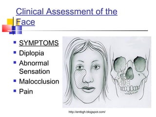 Facial fractures the upper face | PPT