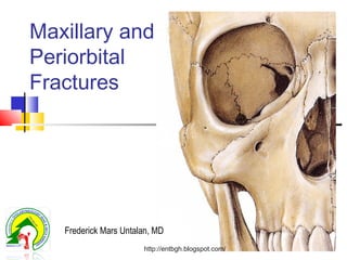 Maxillary and
Periorbital
Fractures
Frederick Mars Untalan, MD
http://entbgh.blogspot.com/
 