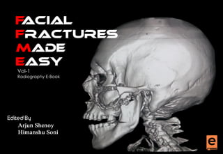 FACIAL
FRACTURES
MADE
EASY
Edited By
Arjun Shenoy
Himanshu Soni
Vol-1
Radiography E-Book
 