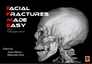 FACIAL
FRACTURES
MADE
EASY
Edited By
Arjun Shenoy
Himanshu Soni
Vol-1
Radiography E-Book
 