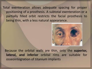 Facial implant and implant retained craniofacial prostheses nn | PPTX