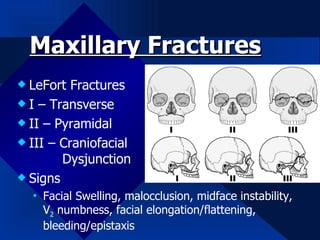 Maxillary Fractures ,[object Object],[object Object],[object Object],[object Object],[object Object],[object Object]