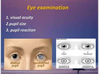 Eye examination
1. visual acuity
2.pupil size
3. pupil reaction
 