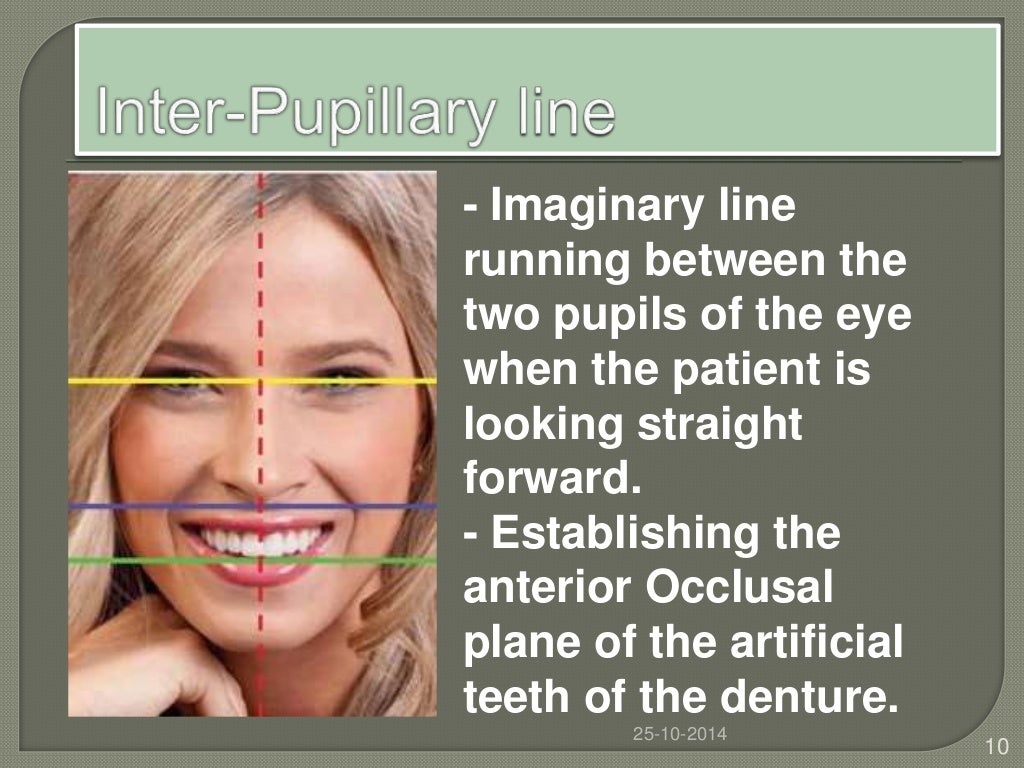 Facial landmarks & its role in prosthodontics