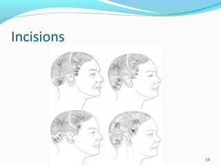 Incisions
18
 
