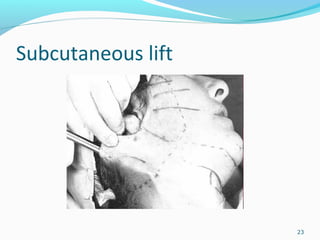 Subcutaneous lift
23
 