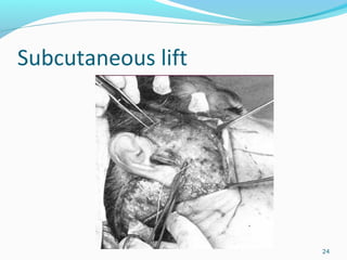 Subcutaneous lift
24
 