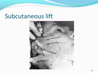 Subcutaneous lift
25
 