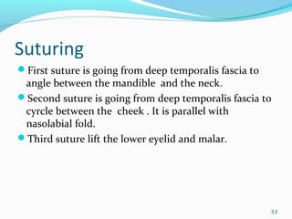 Suturing
First suture is going from deep temporalis fascia to
angle between the mandible and the neck.
Second suture is going from deep temporalis fascia to
cyrcle between the cheek . It is parallel with
nasolabial fold.
Third suture lift the lower eyelid and malar.
53
 