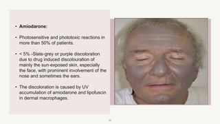 Facial Melanosis.pptx