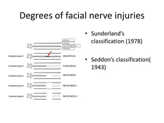 Facial nerve traumatic injury and repair | PPTX