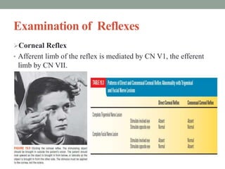Examination of Reflexes
Corneal Reflex
• Afferent limb of the reflex is mediated by CN V1, the efferent
limb by CN VII.
 