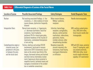 Localization of Peripheral Facial
Nerve Palsy
 