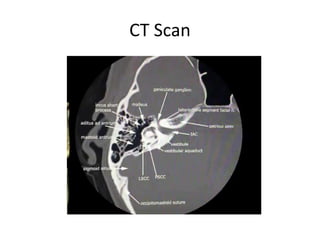CT Scan
 