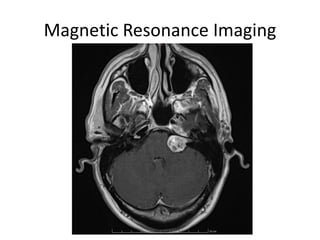 Magnetic Resonance Imaging
 