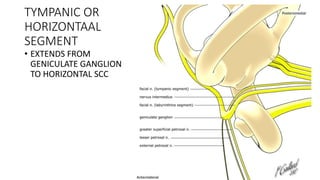 TYMPANIC OR
HORIZONTAAL
SEGMENT
• EXTENDS FROM
GENICULATE GANGLION
TO HORIZONTAL SCC
 