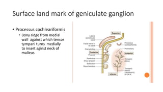 Surface land mark of geniculate ganglion
• Processus cochleariformis
• Bony ridge from medial
wall against which tensor
tympani turns medially
to insert aginst neck of
malleus
 