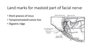 Land marks for mastoid part of facial nerve
• Short process of incus
• Tympanomastoid suture line
• Digastric ridge
 