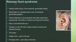 
Ramsay Hunt syndrome
 Herpes zoster oticus, Hunt sydrome, geniculate herpes
 Reactivation of varicella zoster visur involving the
geniculate ganglion.
 Facial weakness is accompanied with taste impairment,
hyperacusis, dimunition of salivary and lacrimal secretion.
 Pain in and behind the ear +
 Vesicles on the TM, EAC, lateral surface of pinna and
mastoid process.
 Two types :
 Otalgic form – pain in the ear
 Prosolgic form – pain deep in the face
 