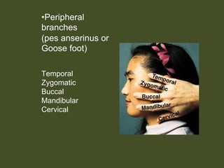 •Peripheral
branches
(pes anserinus or
Goose foot)
Temporal
Zygomatic
Buccal
Mandibular
Cervical
 