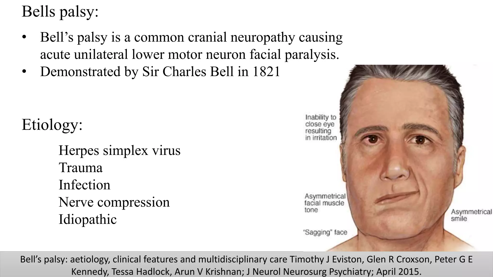 Facial nerve | PPTX