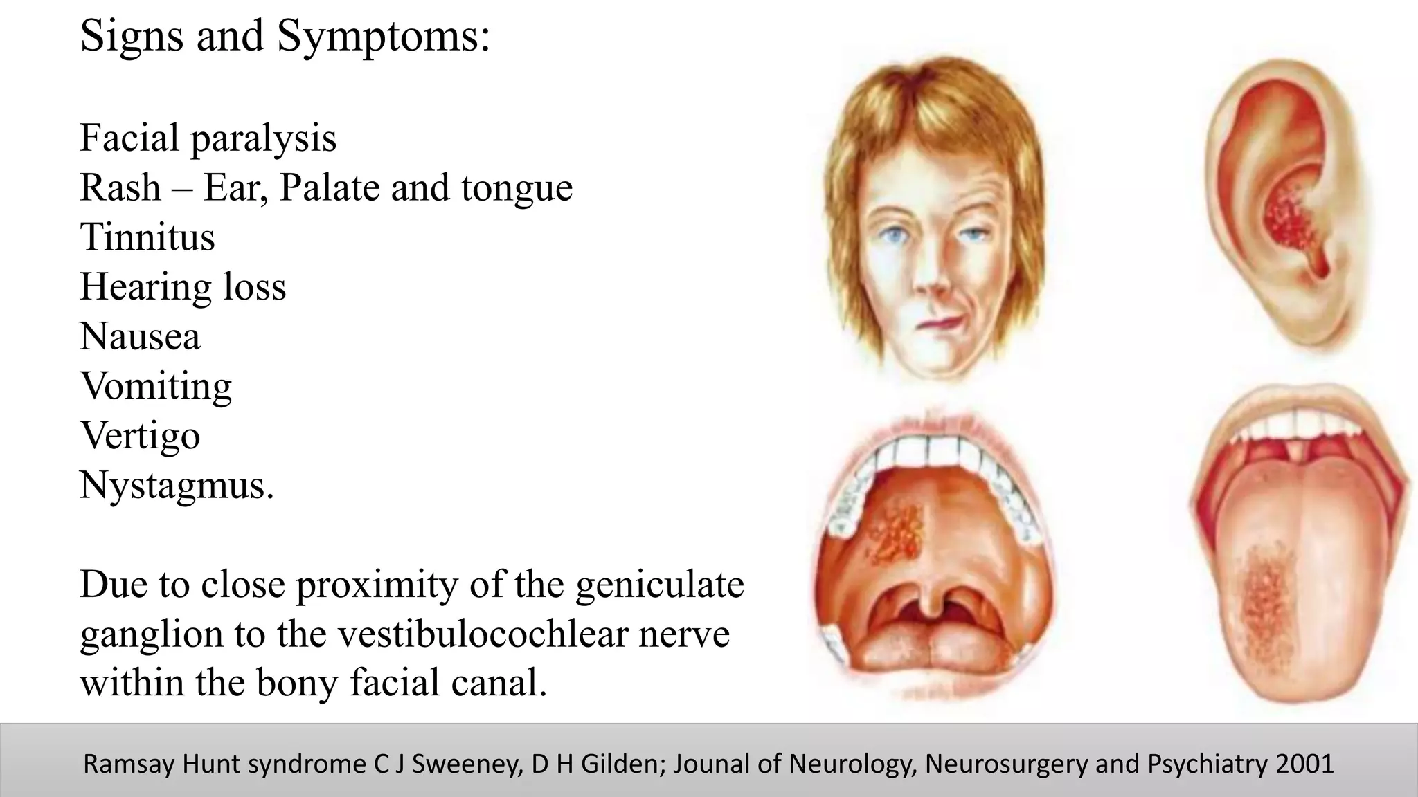 Facial nerve | PPTX