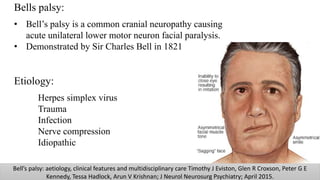 Bells palsy:
• Bell’s palsy is a common cranial neuropathy causing
acute unilateral lower motor neuron facial paralysis.
• Demonstrated by Sir Charles Bell in 1821
Etiology:
Herpes simplex virus
Trauma
Infection
Nerve compression
Idiopathic
Bell’s palsy: aetiology, clinical features and multidisciplinary care Timothy J Eviston, Glen R Croxson, Peter G E
Kennedy, Tessa Hadlock, Arun V Krishnan; J Neurol Neurosurg Psychiatry; April 2015.
 