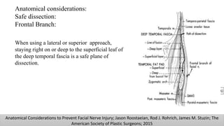 Anatomical considerations:
Safe dissection:
Frontal Branch:
When using a lateral or superior approach,
staying right on or deep to the superficial leaf of
the deep temporal fascia is a safe plane of
dissection.
Anatomical Considerations to Prevent Facial Nerve Injury; Jason Roostaeian, Rod J. Rohrich, James M. Stuzin; The
American Society of Plastic Surgeons; 2015
 