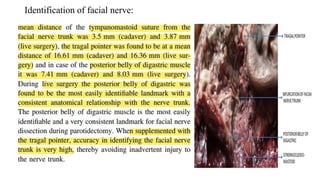Identification of facial nerve:
 