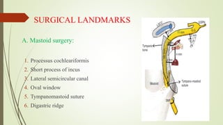 SURGICAL LANDMARKS
1. Processus cochleariformis
2. Short process of incus
3. Lateral semicircular canal
4. Oval window
5. Tympanomastoid suture
6. Digastric ridge
A. Mastoid surgery:
 