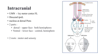 Intracranial
• UMN - 1ry motor cortex FL
• Descend ipsiL
• nucleus at dorsal Pons
• 2 parts :
• dorsal – upper face- both hemispheres
• Ventral – lower face – contraL hemisphere
• 2 roots : motor and sensory
 