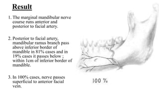 Marginal Ramus Facial nerve.pptx