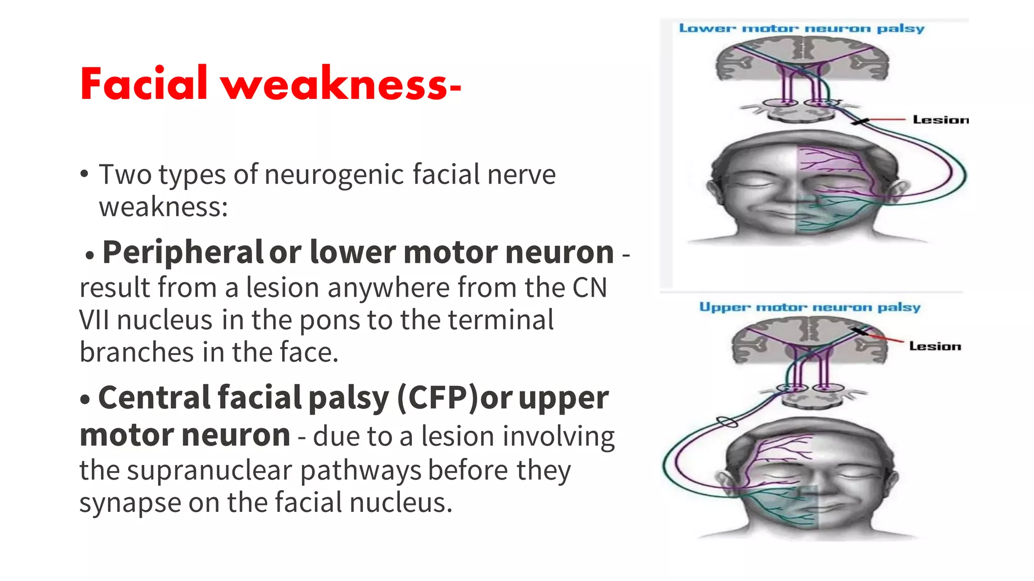 facial nerve by Dr. Roop | PDF