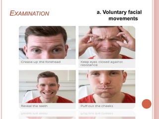 EXAMINATION a. Voluntary facial
movements
 