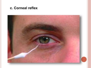 c. Corneal reflex
 