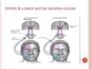 UPPER & LOWER MOTOR NEURON LESION
 