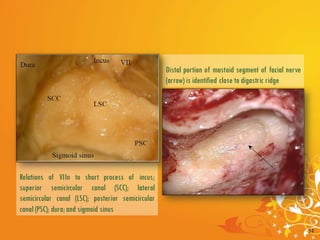 Facial Nerve and Its Clinical Importance | PDF