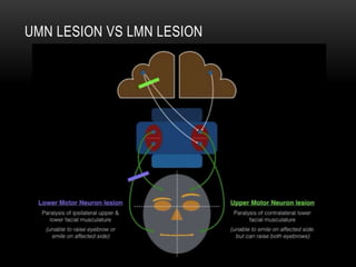 UMN LESION VS LMN LESION
 