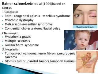 Rainer schmelzein et al (1999)based on
causes
1.Congenital
 Rare- congenital aplasia- moebius syndrome
 Myotonic dystrophy
 Melkersson-rosenthal syndrome
 Congenital cholesteatoma/facial palsy
2.Neurologic:
 Myasthenia gravis
 Multiple sclerosis
 Gullain barre syndrome
3. Neoplastic
 Tumors-schwannoma,neuro fibroma,neurogenic
sarcoma
 Glomus tumor,,parotid tumors,temporal tumors
 