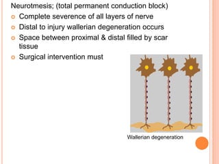 Neurotmesis; (total permanent conduction block)
 Complete severence of all layers of nerve
 Distal to injury wallerian degeneration occurs
 Space between proximal & distal filled by scar
tissue
 Surgical intervention must
Wallerian degeneration
 