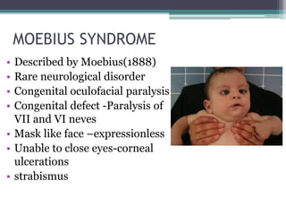 MOEBIUS SYNDROME
• Described by Moebius(1888)
• Rare neurological disorder
• Congenital oculofacial paralysis
• Congenital defect -Paralysis of
VII and VI neves
• Mask like face –expressionless
• Unable to close eyes-corneal
ulcerations
• strabismus
 