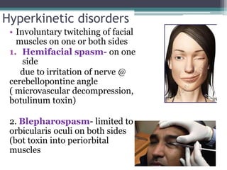 Hyperkinetic disorders
• Involuntary twitching of facial
muscles on one or both sides
1. Hemifacial spasm- on one
side
due to irritation of nerve @
cerebellopontine angle
( microvascular decompression,
botulinum toxin)
2. Blepharospasm- limited to
orbicularis oculi on both sides
(bot toxin into periorbital
muscles
 
