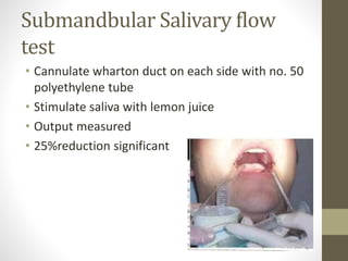 Submandbular Salivary flow
test
• Cannulate wharton duct on each side with no. 50
polyethylene tube
• Stimulate saliva with lemon juice
• Output measured
• 25%reduction significant
 