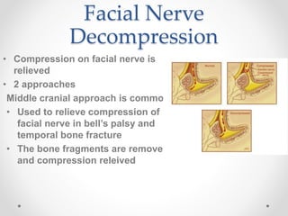 Facial Nerve
Decompression
• Compression on facial nerve is
relieved
• 2 approaches
Middle cranial approach is common
• Used to relieve compression of
facial nerve in bell’s palsy and
temporal bone fracture
• The bone fragments are removed
and compression releived
 