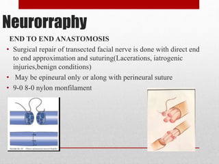 Neurorraphy
END TO END ANASTOMOSIS
• Surgical repair of transected facial nerve is done with direct end
to end approximation and suturing(Lacerations, iatrogenic
injuries,benign conditions)
• May be epineural only or along with perineural suture
• 9-0 8-0 nylon monfilament
 