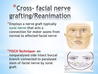 *
*Employs a nerve graft typically
sural nerve that acts a
connection for motor axons from
normal to affected facial nerve
*FISCH Technique- on
nonparalysed side intact buccal
branch connected to paralysed
stem of facial nerve by sural
graft
 